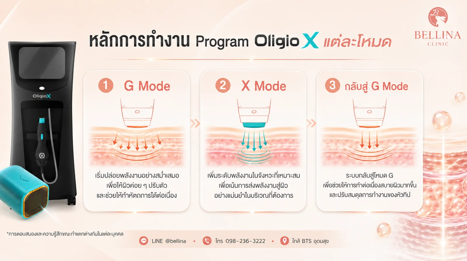 หลักการทำงาน Oligio X แต่ละโหมด: G Mode, X Mode และกลับสู่ G Mode